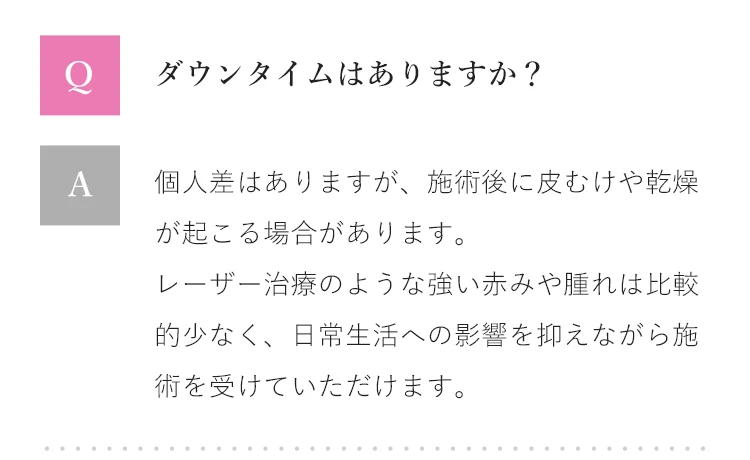 Q&A ダウンタイムはありますか？
